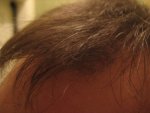 10 monthd front left dry..jpg