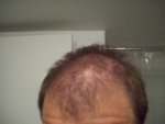 carl-headpick3.jpg