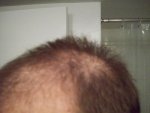 carlspick-head1.jpg