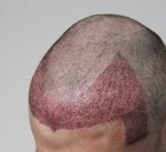 Frontal hl .jpg