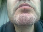 beard at 1 wk.jpg