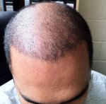 21 days after.JPG