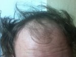 HAIR FRONT pulled apart.jpg