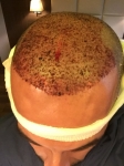 1. AfterOp (7).JPG
