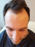 before.jpg
