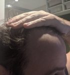 side of head.jpg