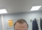 hair line.jpg