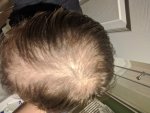 hair parted.jpg