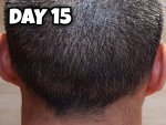 Day 15 Donor.jpg Day 15 Donor.jpg