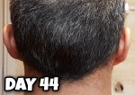 Day 44 Donor Final.jpg Day 44 Donor Final.jpg