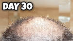 Crown 30.png Crown 30.png