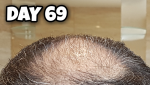 Crown 69.png Crown 69.png