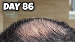 Crown 86.png Crown 86.png
