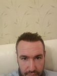 Dr Bisnaga hair transplant 2.jpg