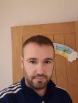 Dr Bisnaga hair transplant 4.jpg