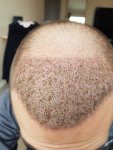 Dr. Bruno Ferreira - hair restoration.jpg