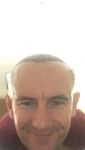 Hair transplant Turkey Dr Acar 1.PNG