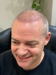 The Hair Dr Leeds Hair Transplant 3.jpg