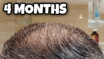 4 Months Crown.png 4 Months Crown.png