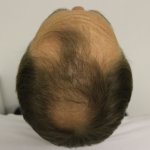 Dr Edward Maitland Ball 18.jpg