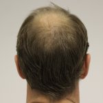 Dr Edward Maitland Ball 20.jpg