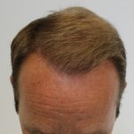 Dr Edward Maitland Ball  3.jpg