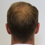 Dr Edward Maitland Ball 9.jpg