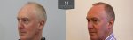 ID1624_Before_After_left_45.jpg