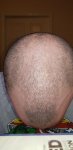 top head.jpg top head.jpg