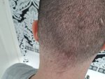 back of head.jpg back of head.jpg