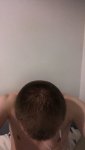 Dr Lupanzula FUE Hair Transplant17.jpeg Dr Lupanzula FUE Hair Transplant17.jpeg