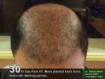 30th Day Post HT.jpg