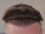 7 month scraped back.jpg