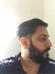 Cosmedica hair transplant Dr Acar3.jpg Cosmedica hair transplant Dr Acar3.jpg