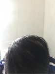 Cosmedica hair transplant Dr Acar4.jpg Cosmedica hair transplant Dr Acar4.jpg