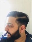 Cosmedica hair transplant Dr Acar5.jpg Cosmedica hair transplant Dr Acar5.jpg
