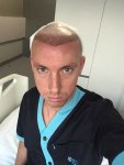Dr Koray Erdogan - Asmed hair transplant5.jpeg