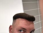 Dr Koray Erdogan - Asmed hair transplant12.jpeg