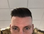 Dr Koray Erdogan - Asmed hair transplant22.jpeg