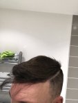 Dr Koray Erdogan - Asmed hair transplant2.jpeg