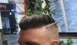 Dr Koray Erdogan - Asmed hair transplant6.jpeg