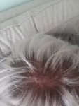 18 year old possibly hair loss in my crown.jpg