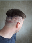FUE EUROPE 2.png