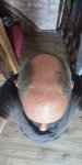 Norwood 5 hair loss.jpg