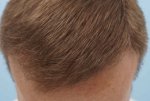 Farjo Hair Institute1.jpg