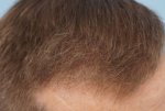 Farjo Hair Institute2.jpg