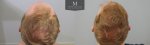 ID1257_Before_After_above-2.jpg