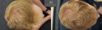 ID1257_Before_After_Above.jpg