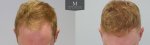 ID1257_Before_After_Front_tilt.jpg