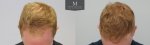 ID1257_Before_After_Front_top.jpg